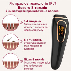 Фотоепілятор IPL Hair Removal — 999900 спалахів, LED дисплей, безболісна епіляція вдома
